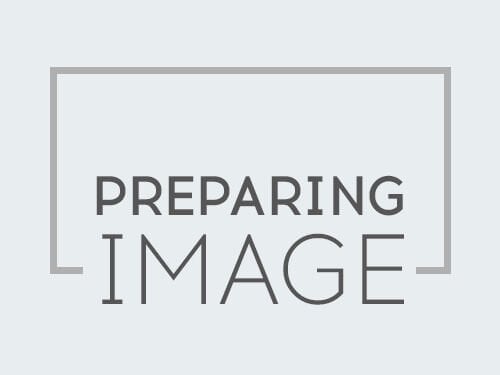 Renault Megane Kapı Kolu 2 Kapı Paslanmaz Çelik (Sensörlü) 2009-